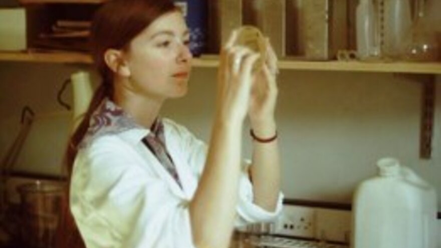 Judith Narvhus as a phd-student at Cytopathology Unit, St. Helier hospital, University of Surrey, 1972 – 1978.
