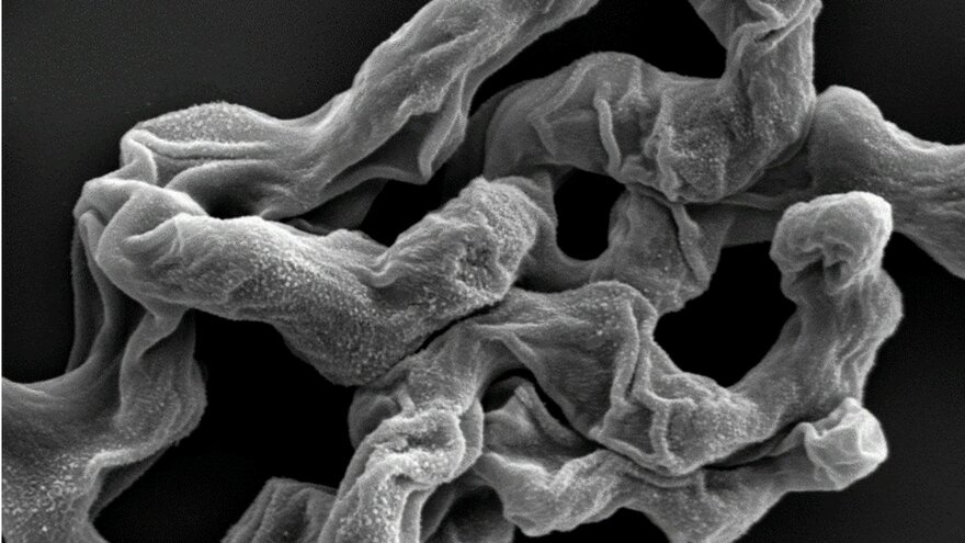 Ultrastructure of P. variotii after drying  
