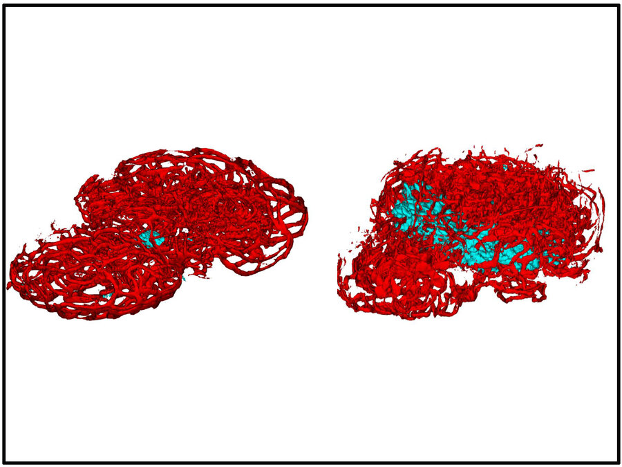 Medakahypofyse fra hannfisk (til venstre) og hunnfisk. Turkise områder viser de endokrine cellene tyrotryfer.
