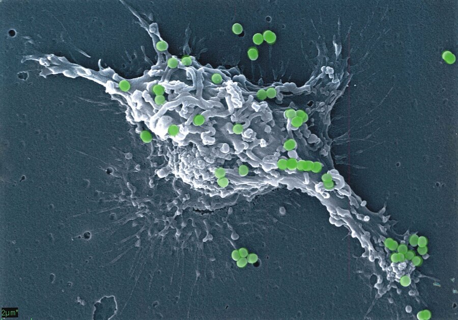 Slik ser det ut når ei immuncelle – ei dendrittisk celle – bind Methylococcus-bakteriar til overflata. Tor Erling Lea har teke biletet med sveipeelektronmikroskopi, og grønfargen er lagt på etterpå. 