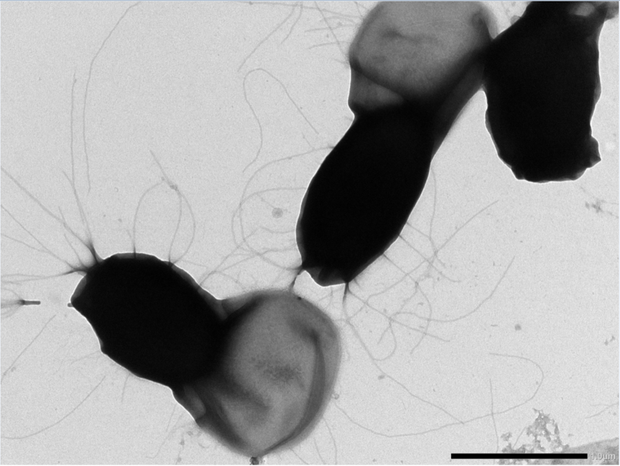 Et transmisjonselektronmikroskopibilde av Bacillus cereus-sporer. Disse sporene er veldig problematiske for meieriindustrien siden de overlever varmebehandling og binder seg hardt til rørsystemer og utstyr. Forskerne tror de lange trådene på sporeoverflat