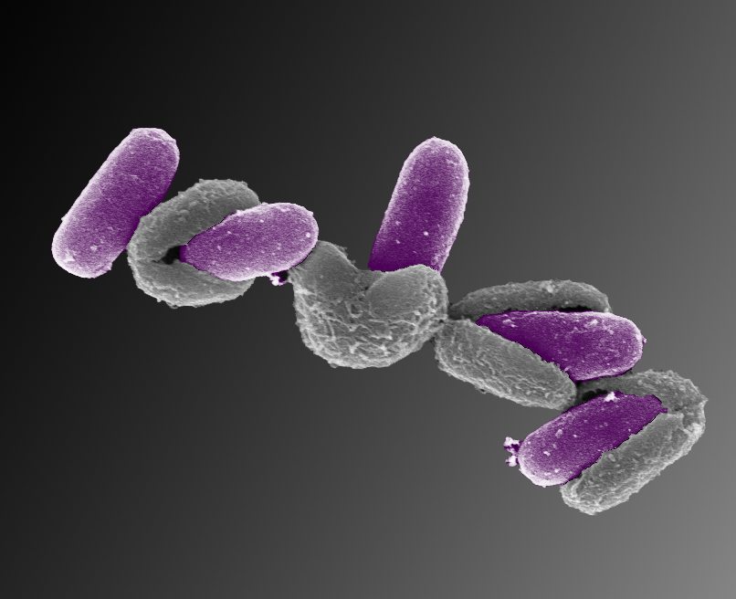 Dette bildet viser flere Bacillus licheniformis-sporer som våkner, eller germinerer. Bakteriene er egentlig ikke lilla, men bildet er fargelagt for å tydeliggjøre prosessen.