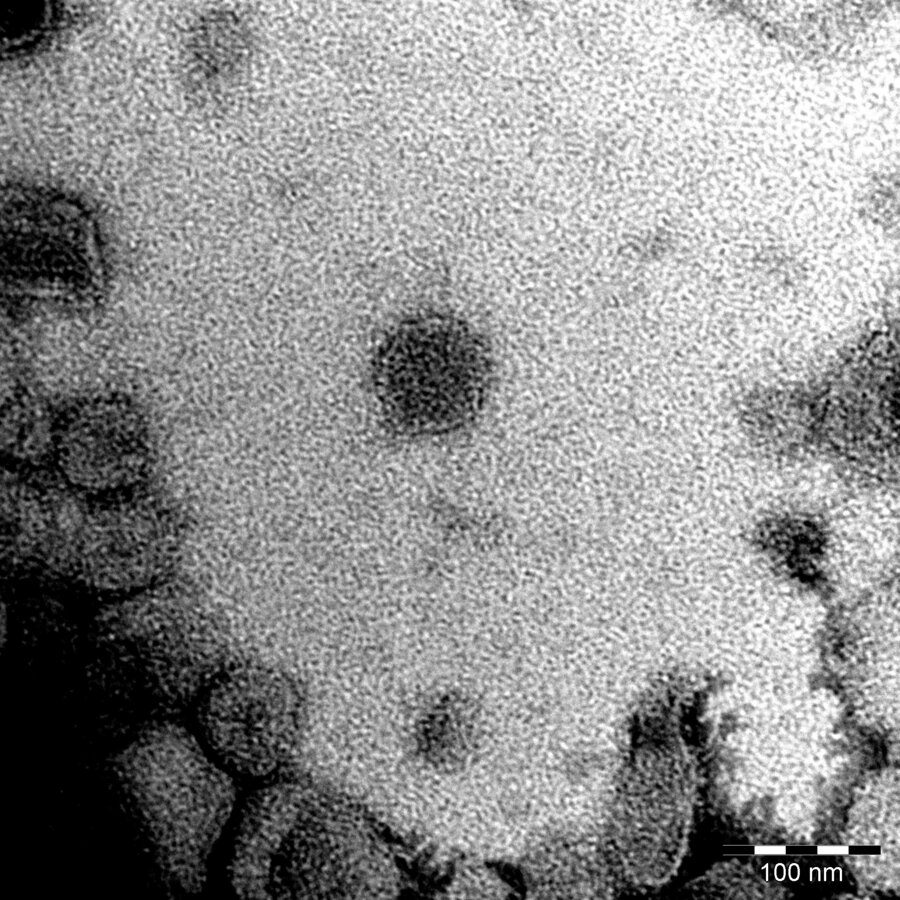 Dette er en ekstracellulær vesikkel fra fersk NRF-melk. Den er ca. 80 nanometer i diameter, altså 0.00008 millimeter. Prøven er farget med uranylaceat, og bildet er tatt med transmisjons-elektronmikroskopet ved Imaging Center Campus Ås, NMBU.