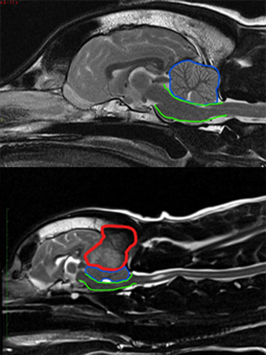 Det øverste bildet er et MR-bilde av en frisk hundehjerne. Det nederst bildet er Mollys hjerne før operasjonen. Det grønne området markerer hjernestammen. Det blå er lillehjernen. Det røde området viser svulsten i Mollys hjerne. Bildet viser tydelig hvord