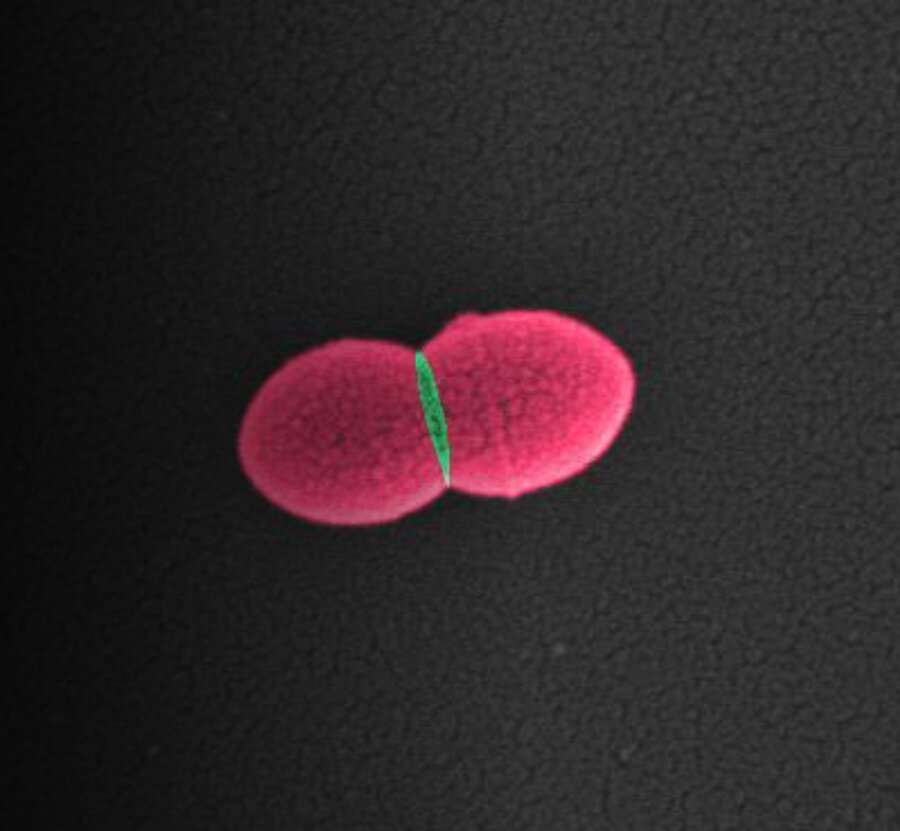 Pneumokokker (Streptococcus pneumoniae) deler seg fra én celle til to datterceller. Hvis vi forstår hva som skjer i delingssonen – det grønne området – kan vi utvikle nye antibiotika som hemmer delingen. Forskningsgruppen Molekylær mikrobiologi, med utspr