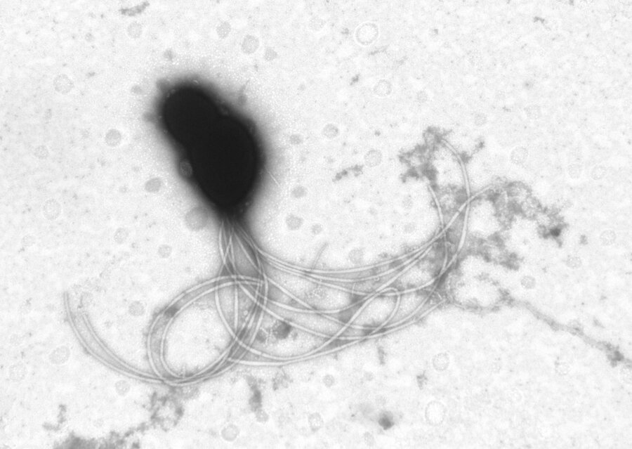 Bakterien Aliivibrio salmonicida forårsaker sykdommen kaldtvannsvibriose hos laks. Nørstebøs forskning viser at overflaten, flagellene og LPS, har stor betydning i hvordan sykdommen utvikler seg.